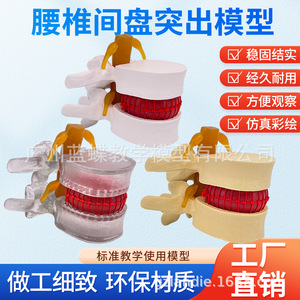 Simulation pédagogique du modèle de hernie discale lombaire humaine, démonstration de mesure de la pression vertébrale, vertébral - Product Image 1