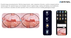 CE phê duyệt y tế kỹ thuật số ống nhòm kính hiển vi dọc phụ khoa soi cổ tử cung cho phụ khoa - Product Image 6