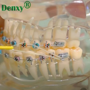 Modello dentale Denxy con staffa metallica legatura legatura catena elastica orto Typodont dentale per trattamento di dimostrazione ortodontica - Product Image 3