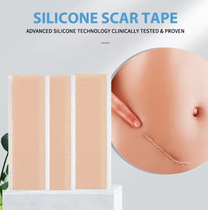 ผลิตภัณฑ์รักษารอยแผลเป็นจากสิว แผ่นแปะลดรอยแผลเป็นเกรดทางการแพทย์ แผ่นซิลิโคนลดรอยแผลเป็นแบบม้วน - Product Image 4