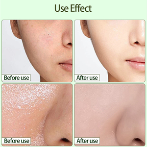 หน้ากากดินน้ำมันออร์แกนิก,มาส์กการดูแลผิวหน้าสีเขียวใบชา - Product Image 5