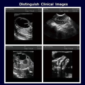 Échographe portable entièrement numérique <span class=keywords><strong>3D</strong></span>/4D, machine à ultrasons économique pour usage humain - Product Image 3