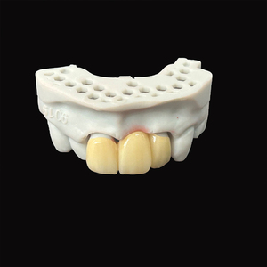 Restauración <span class=keywords><strong>fija</strong></span> Laboratorio dental asequible <span class=keywords><strong>Precio</strong></span> de China Puentes de corona de cerámica de metal <span class=keywords><strong>Precio</strong></span> barato Pfm - Product Image 3