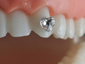 Gioielli Dentali a Forma di Cuore in Cristallo - Gemme Dentali Premium per un <span class=keywords><strong>Sorriso</strong></span> Scintillante, Gioielli in <span class=keywords><strong>Stile</strong></span> Hip Hop Punk - Product Image 6
