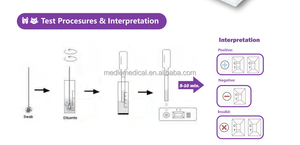 Kit de test rapide d'anticorps et d'antigènes TOXO IgG IgM pour chiens et chats, test de diagnostic vétérinaire Toxoplasma Gondii - Product Image 2