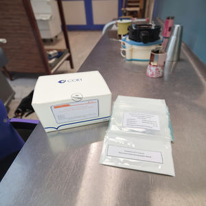 Kit deteksi <span class=keywords><strong>Procalcitonin</strong></span> cepat menggunakan metode diagnotographic fluoresensi untuk Diagnosis Sepsis awal - Product Image 1