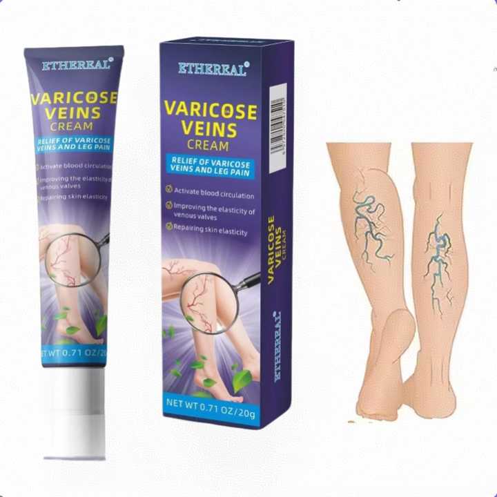 Varicose Vein Massage Cream for Healthcare Supply