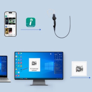 Endoscope vétérinaire jetable flexible et efficace - Connecté par USB pour l'élimination des corps étrangers abdominaux chez les animaux de compagnie - Product Image 6