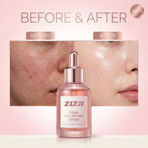 Suero PDRN 10000ppm con ADN de Salmón, Péptido Rosa, Suero Iluminador, Reparación de la Barrera Cutánea, Piel de Cristal, Hidratante, Antienvejecimiento, Cuidado de la Piel Coreano - Product Image 1