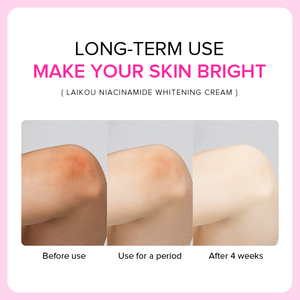 LAIKOU 100g Lotion hydratante éclaircissante à la niacinamide, ingrédients à l'acide hyaluronique, crème éclaircissante pour les aisselles et le corps - Product Image 3