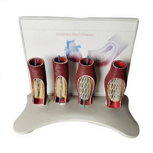 Modelo Anatómico de <span class=keywords><strong>Stent</strong></span> Vascular Humano SMM3192 (PVC) para Educación en Ciencias Médicas - Arteria Coronaria - Product Image 2