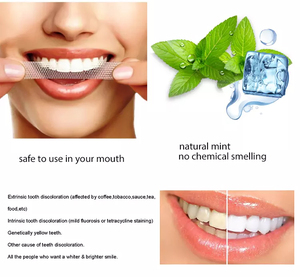 3D 5D 9D bán buôn răng tự nhiên làm trắng Dải Peroxide blanchiment Des vết lõm làm trắng răng sản phẩm nha khoa làm trắng dải - Product Image 6