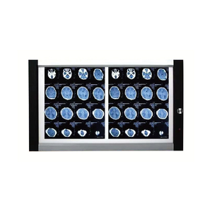 Ein/Doppel/Drei/Vier-Bildschirme zahnärztliches superschlankes Negatoskop LED-Röntgenfolie-Ansichtlicht - Product Image 3