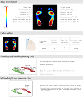 Système de mesure de la pression plantaire par points de détection 112x112 | Traitement médical et détecteur de pression pour pieds diabétiques