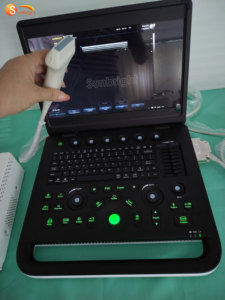 Mesin USG Digital Portabel SUN-800C untuk Kehamilan, Rumah Sakit, dan Ekokardiografi - Product Image 4