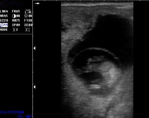 Échographe portable noir et <span class=keywords><strong>blanc</strong></span> économique pour usage médical et vétérinaire - Product Image 5