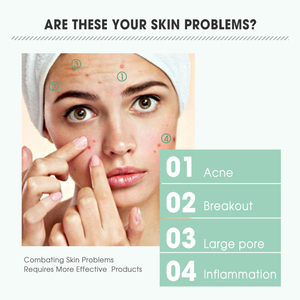 Siero Viso Coreano di Alta Qualità con Acido Salicilico Anti-Acne, Riparatore della Pelle, per Cura del Viso e Microneedling ad Uso Domestico - Product Image 2