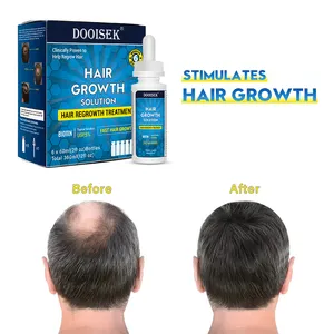 Factory Sale Anti Loss Regrowth Treatment Scalp Baldness 100% Pure Natural Biotin Fast Effective Hair Growth Serum