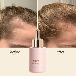 لوجو خاص لتكييف الشعر SOS لإصلاح الرطوبة زيت الألوة فيرا دايكون خلاصة بذور البيوتن - Product Image 3