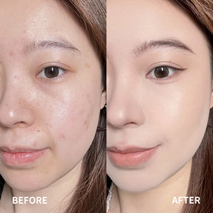 Nhãn hiệu riêng lưu huỳnh Niacinamide bột để kem mụn trứng cá mụn loại bỏ & đỏ làm dịu da mặt sản phẩm chăm sóc - Product Image 5