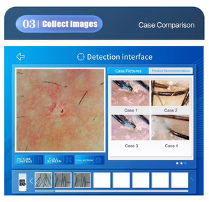 5 trong 1 công cụ phân tích da đầu toàn diện độ nét cao với chức năng báo cáo tự động 200W. - Product Image 6