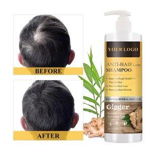 Private Label Organic Hot Hair Fall Loss Treatment Strong Root Shampoo And Conditioner Hair Grower Nourish Shampoo For Hair Loss