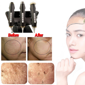 Good Quality Skin Care Exfoliation Capsule Brightening Lightening Co2 Bubble 3 in 1 Spa Oxygen Jet Peel Oxigen Facial <b>Machine</b> - Product Image 5