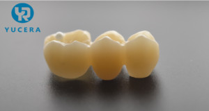 Prothèses dentaires Yucera ST, disques en zircone dentaire multicouches Yucera, disques entièrement en céramique - Product Image 5