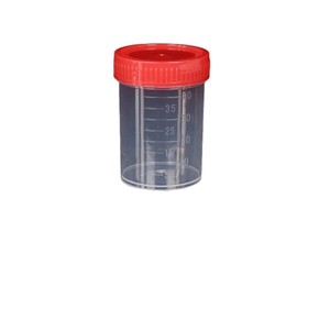 Vaso de Muestreo de Heces Chengbao de 40 ml con Tapa de Rosca de PP para Pruebas de Laboratorio - Product Image 1