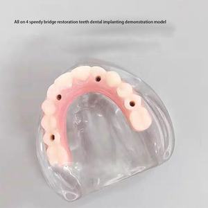 نموذج عرض لتثبيت أسنان واستعادة جسر سريع يتماشى مع الكل في 4 - Product Image 3