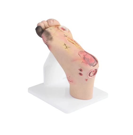 Severe model of hyperglycemia