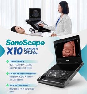 Échographe mobile SonoScape X10/E10 sur chariot, machine à ultrasons noir et blanc avec 3 sondes/système d'échographie vétérinaire - Product Image 1