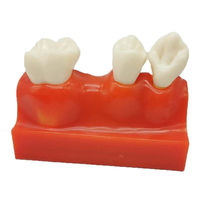 Modelo Dental de Enseñanza, Modelo de Estudio de Odontología, Implante Ortodóntico Extraíble, Modelos de Dientes para Práctica y Entrenamiento