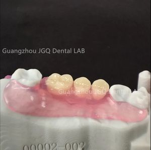 Suministros para dentaduras postizas DIY, dentadura postiza Invisible Valplast, buena nueva técnica protésica, prótesis para dentaduras postizas adelomórficas con buenos precios - Product Image 3