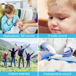Dispositif de Fermeture d'Urgence Efficace pour Lacerations, Protection d'Urgence pour Fermeture de Plaies, Idéal pour les Activités de Plein Air - Product Image 6