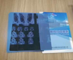 Phim Chụp <span class=keywords><strong>X</strong></span>-quang Y Tế Cho Máy In Laser Bộ Phim In Phun Kỹ Thuật Số <span class=keywords><strong>X</strong></span> Ray Siêu Xanh Y Tế PET Cho Fuji Di Hl <span class=keywords><strong>Kodak</strong></span> Agfa - Product Image 4