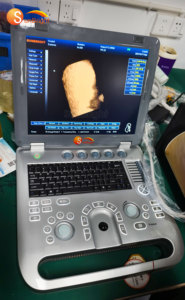 Échographe portable 2D/3D de diagnostic médical électrique de haute qualité - Product Image 4