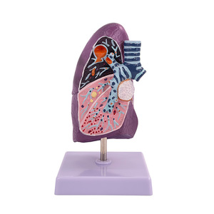 Modelo de pulmón humano, modelo de anatomía patológica del pulmón, sistema respiratorio, modelo de órgano humano, modelo de pulmón enfermo - Product Image 1