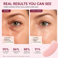 Patchs oculaires personnalisés à micro-aiguilles de peptides roses biologiques PDRN, acide hyaluronique, niacinamide, anti-âge, cernes, patchs à micro-aiguilles