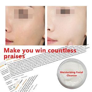 Detergente <span class=keywords><strong>viso</strong></span> quotidiano idratante delicato <span class=keywords><strong>per</strong></span> pelle sensibile incline all'acne e <span class=keywords><strong>Rosacea</strong></span> senza sapone fornito da cosmetici - Product Image 4