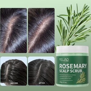 Etiqueta privada Nutritiva Detox Cuidado del cabello Champú de Romero <span class=keywords><strong>Exfoliante</strong></span> para el cabello del cuero cabelludo <span class=keywords><strong>Exfoliante</strong></span> para el cuero cabelludo aceitoso - Product Image 4