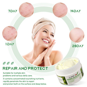 <span class=keywords><strong>Crema</strong></span> para el Acné con Aceite de Árbol de Té OEM, Fórmula Vegana Orgánica con Glicerina para Todo Tipo de Piel - Hidratante y Elimina Cicatrices - Product Image 4