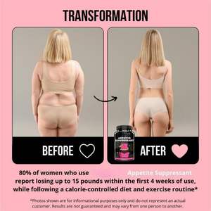Capsules de perte de poids brûle-graisses à vente chaude, métabolisme rapide, capsules de complément alimentaire coupe-faim, étiquette privée d'usine - Product Image 5
