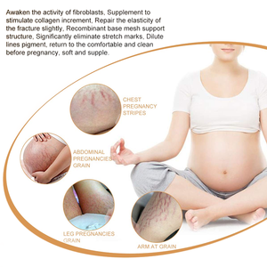 Meilleure lotion au beurre de karité biologique Crème de marque privée pour le corps <span class=keywords><strong>anti</strong></span>-vergetures et raffermissant <span class=keywords><strong>la</strong></span> peau - Product Image 6