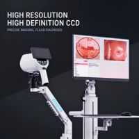 Colposcope numérique HD à zoom optique 40x Kernel GN-500 pour le dépistage cervical et l'examen gynécologique