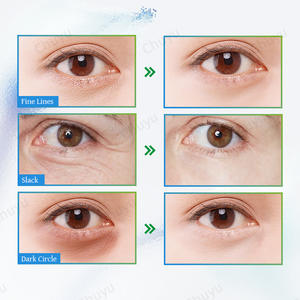 OEM Resveratrol Antiarrugas Hidratante Iluminador Círculo Oscuro Reafirmante Crema de Ojos - Product Image 4