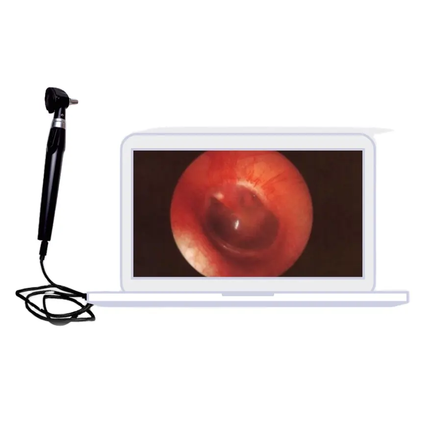 Video otoscope Ent Bộ chẩn đoán otoscope với USB kết nối máy tính và điện thoại Android
