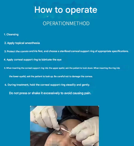 Y tế thép không gỉ Laser mắt lá chắn giác mạc bảo vệ mắt bảo vệ cho CO2 fractional điều trị bằng laser - Product Image 2