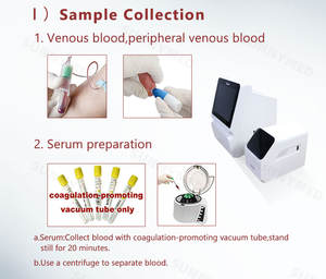 Sistema <span class=keywords><strong>de</strong></span> Bioquímica conveniente y asequible, analizador químico completamente automatizado para plasma <span class=keywords><strong>de</strong></span> suero <span class=keywords><strong>de</strong></span> <span class=keywords><strong>sangre</strong></span> total, el sistema <span class=keywords><strong>de</strong></span> Bioquímica es el más conveniente y asequible - Product Image 6