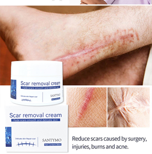 Crema para eliminar <span class=keywords><strong>cicatrices</strong></span> antiguas y manchas oscuras <span class=keywords><strong>en</strong></span> <span class=keywords><strong>las</strong></span> <span class=keywords><strong>piernas</strong></span>, 30g, elimina <span class=keywords><strong>las</strong></span> <span class=keywords><strong>cicatrices</strong></span> postoperatorias, previene eficazmente la proliferación de <span class=keywords><strong>cicatrices</strong></span> después de la cirugía - Product Image 5